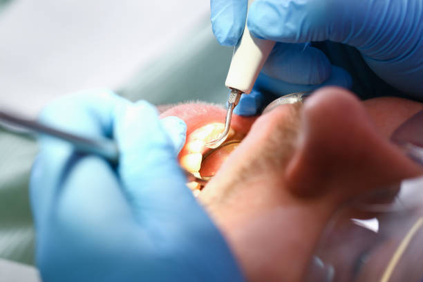 Best Broken or Chipped Tooth Repair in Byram Center, NJ
